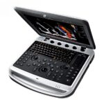 Портативний ультразвуковий сканер CHISON SonoBook 8