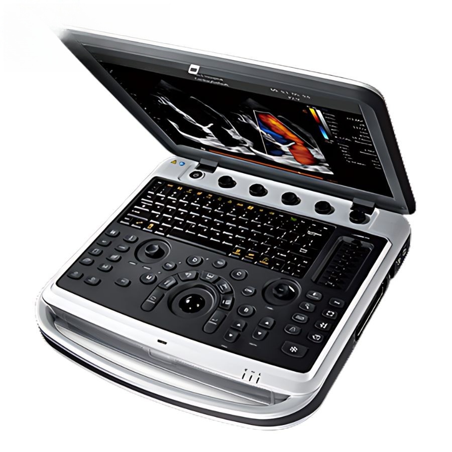 Портативний ультразвуковий сканер CHISON SonoBook 8