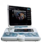 Ультразвуковий апарат MyLab Gamma