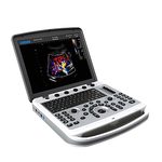 Портативний ультразвуковий сканер CHISON SonoBook 6