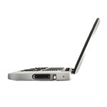 Портативний ультразвуковий сканер CHISON SonoBook 6
