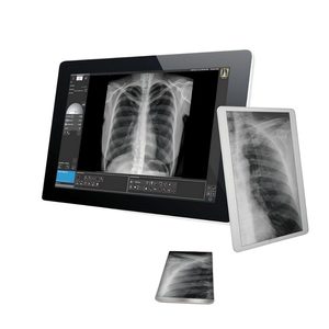 Цифрова система зображень рентгенографії Avanse DR