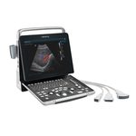 Система ультразвукова діагностична Mindray Z60