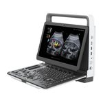 Портативна система ультразвукова діагностична Zoncare M30