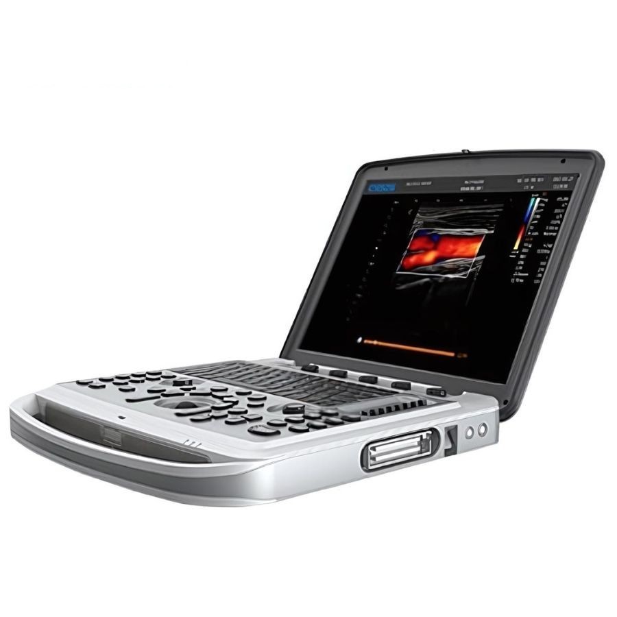 Портативний ультразвуковий сканер CHISON SonoBook 6
