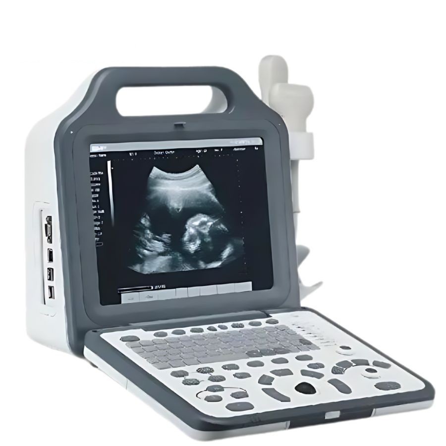 Ультразвуковий сканер EMPEROR ULTRASOUND N5