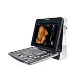 Система ультразвукова діагностична Mindray Z60